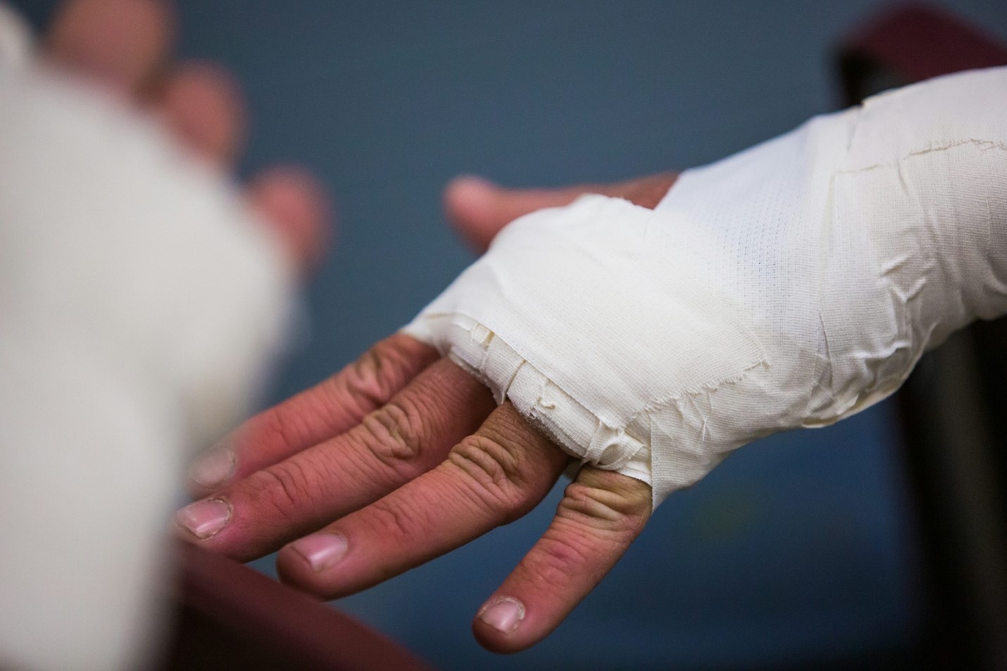 Worker with a plaster cast on an injured hand recovering from a workplace accident